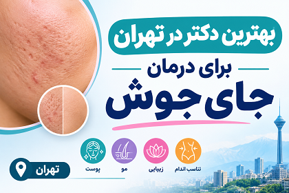 بهترین دکتر در تهران برای درمان جای جوش