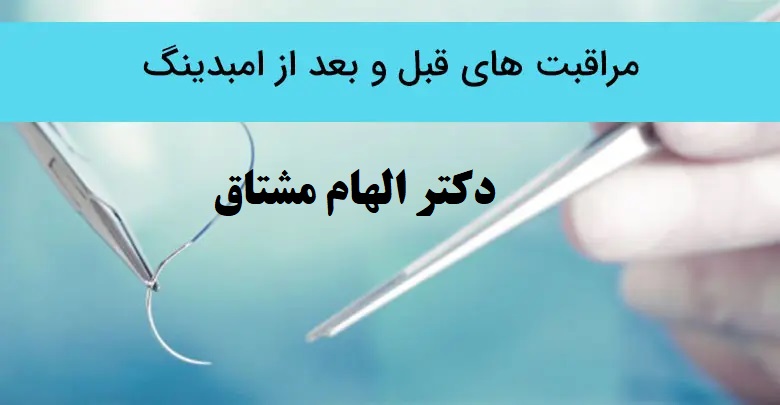 مراقبت های قبل و بعد از امبدینگ