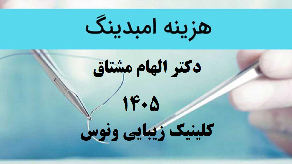 هزینه امبدینگ در سال 1405