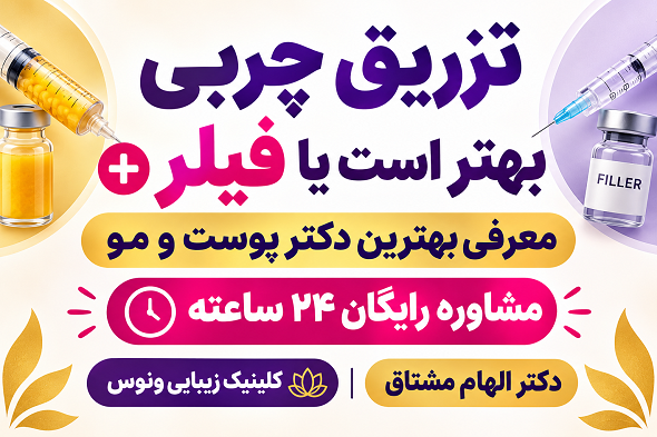 تزریق چربی بهتر است یا فیلر + معرفی بهترین دکتر | مشاوره رایگان ۲۴ ساعته + دکتر الهام مشتاق | کلینیک زیبایی ونوس سعادت آباد